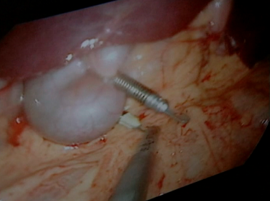 Panorama Regional - Panorama regional - 06/05/10