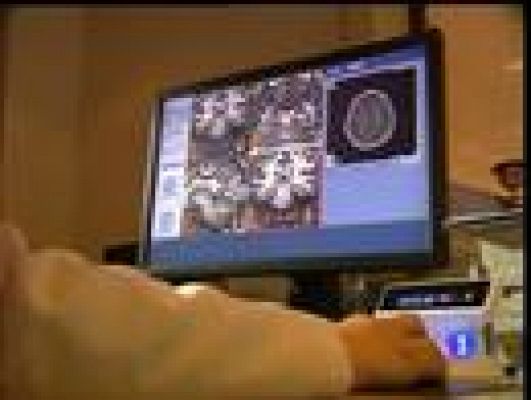  - Madrid cuenta con un nuevo banco de cerebros