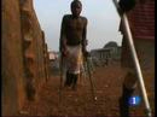  - Amputados y futbolistas