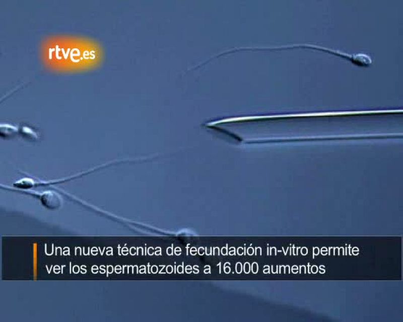 'Casting' de espermatozoides