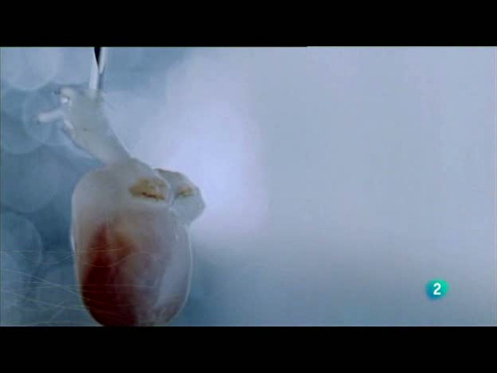 Redes (27/06/10): La nueva cardiología