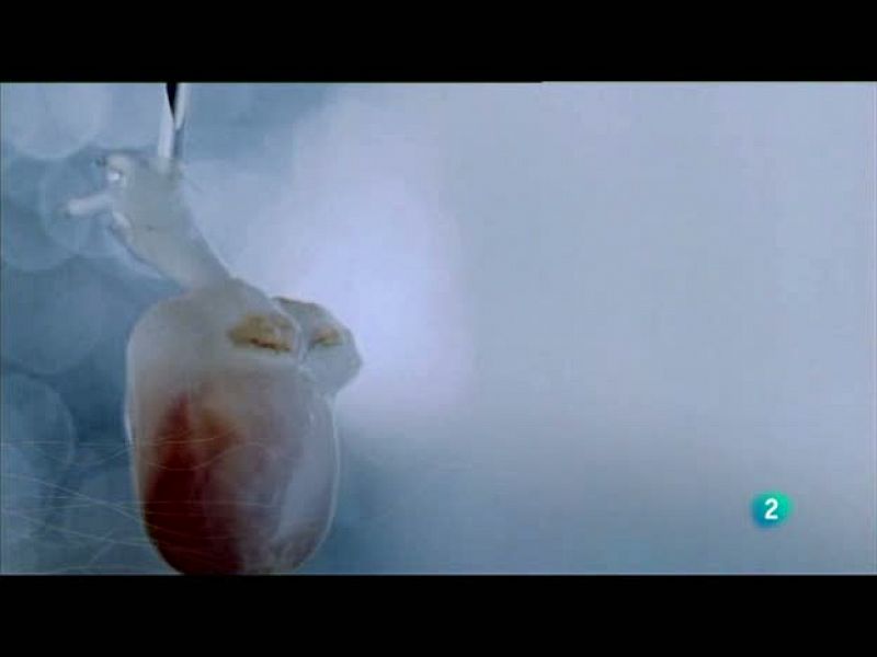  Redes (27/06/10): La nueva cardiología