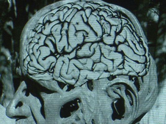 Ciencia y tecnología en Rtve.es - La memoria no siempre está perdida