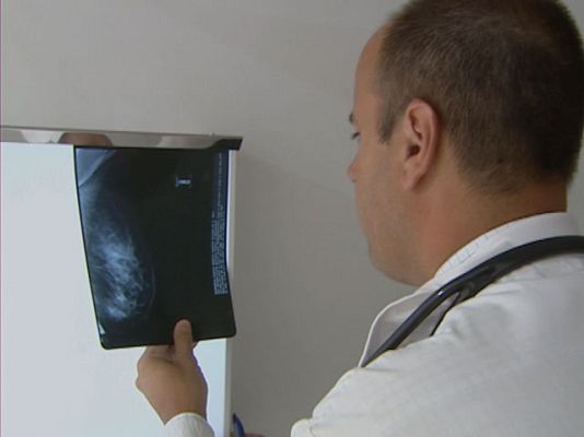 Ciencia y tecnología en Rtve.es - El cáncer de mama en hombres