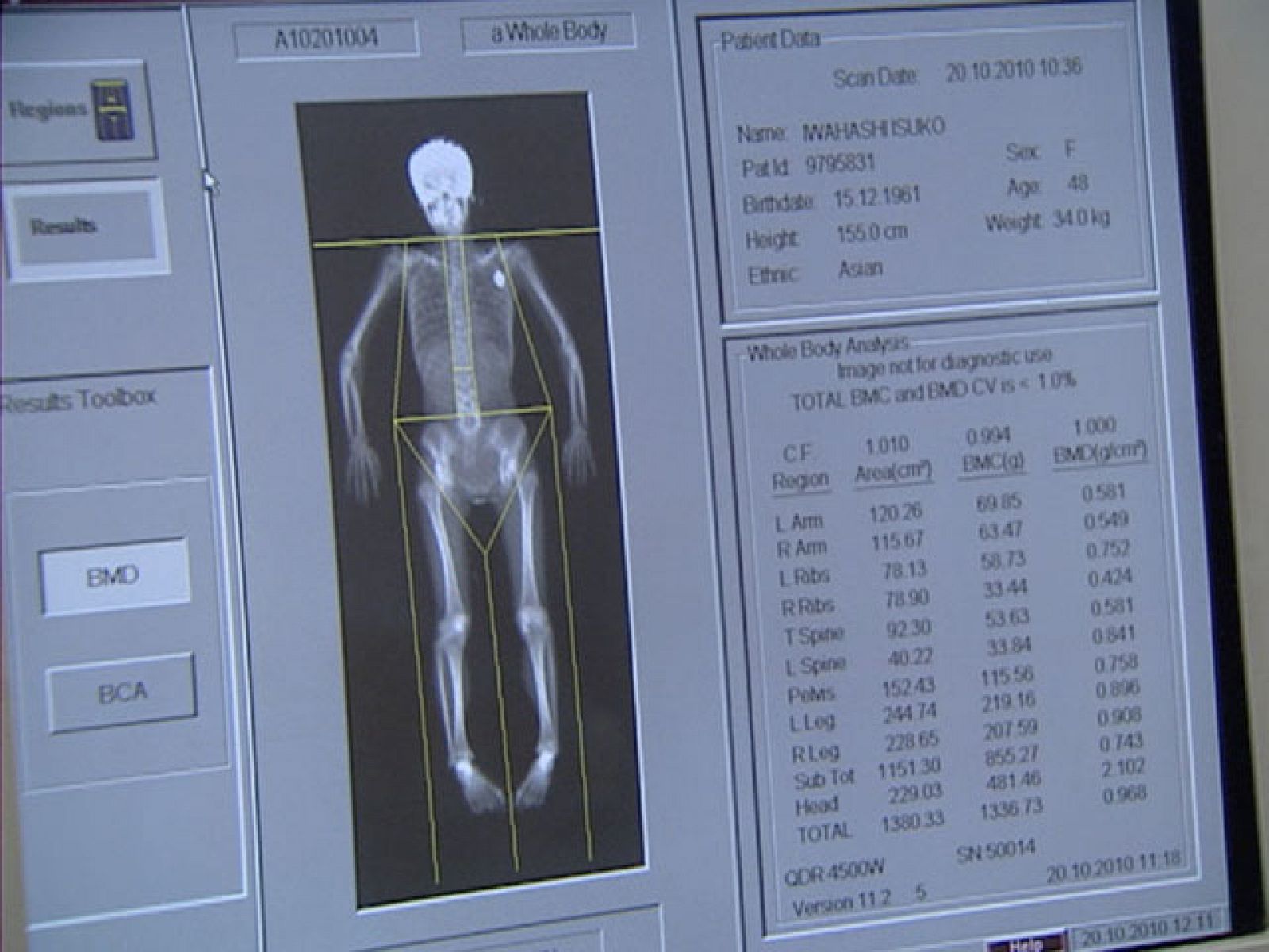 Informativo de Madrid (20/10/10)