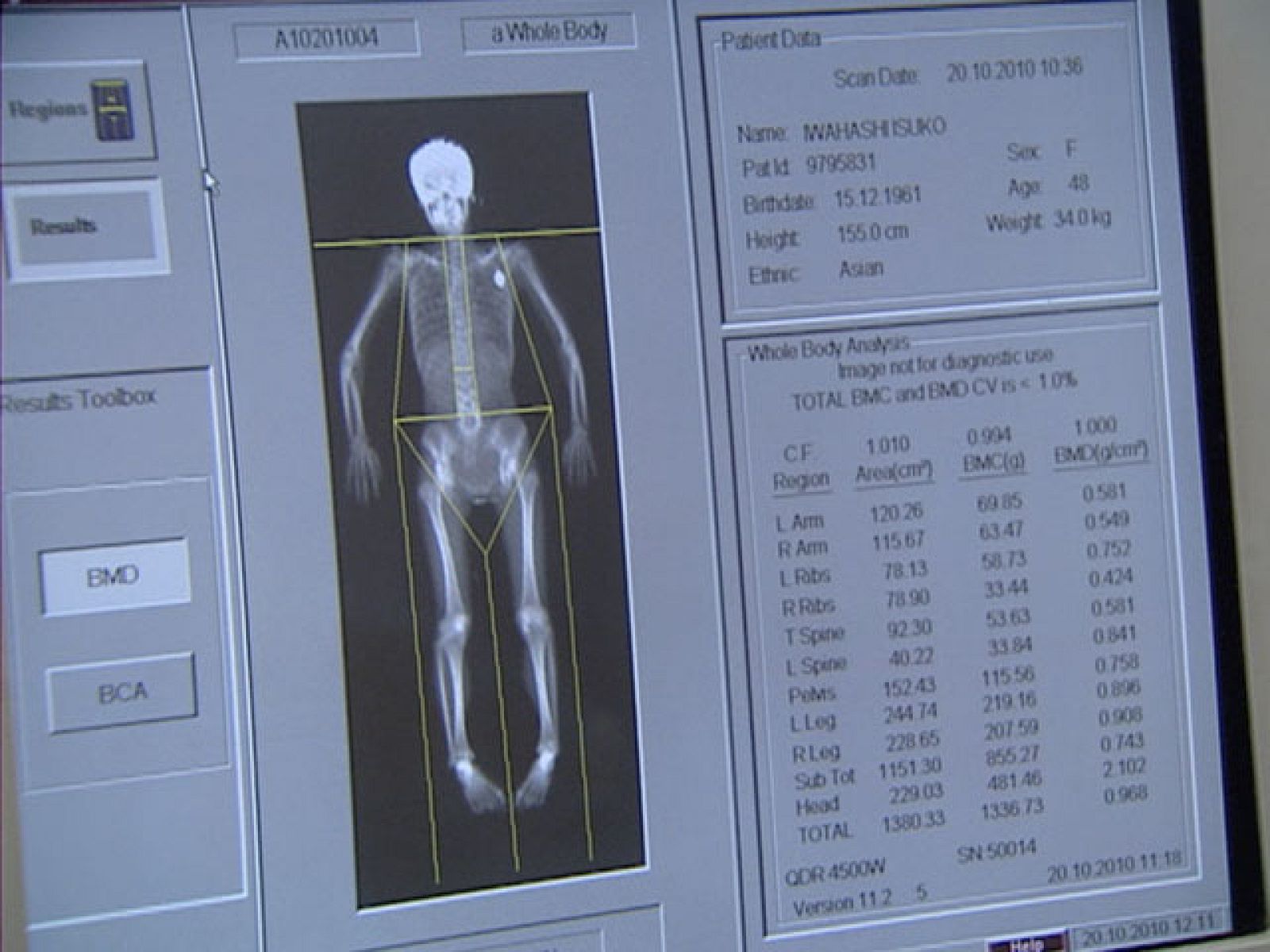 Informativo de Madrid (20/10/10)