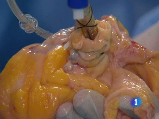 Ciencia y tecnología en Rtve.es - Órganos bioartificiales