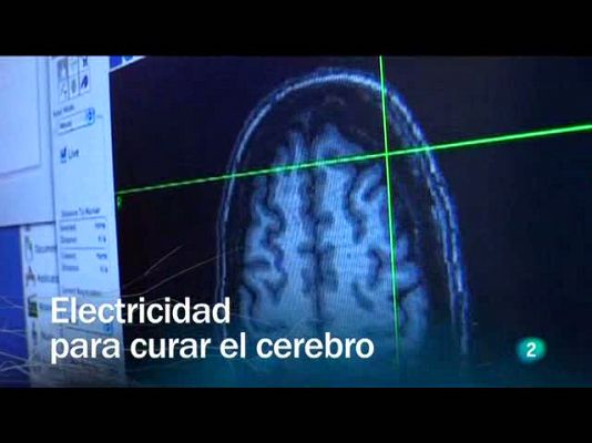 Electricidad para curar el cerebro