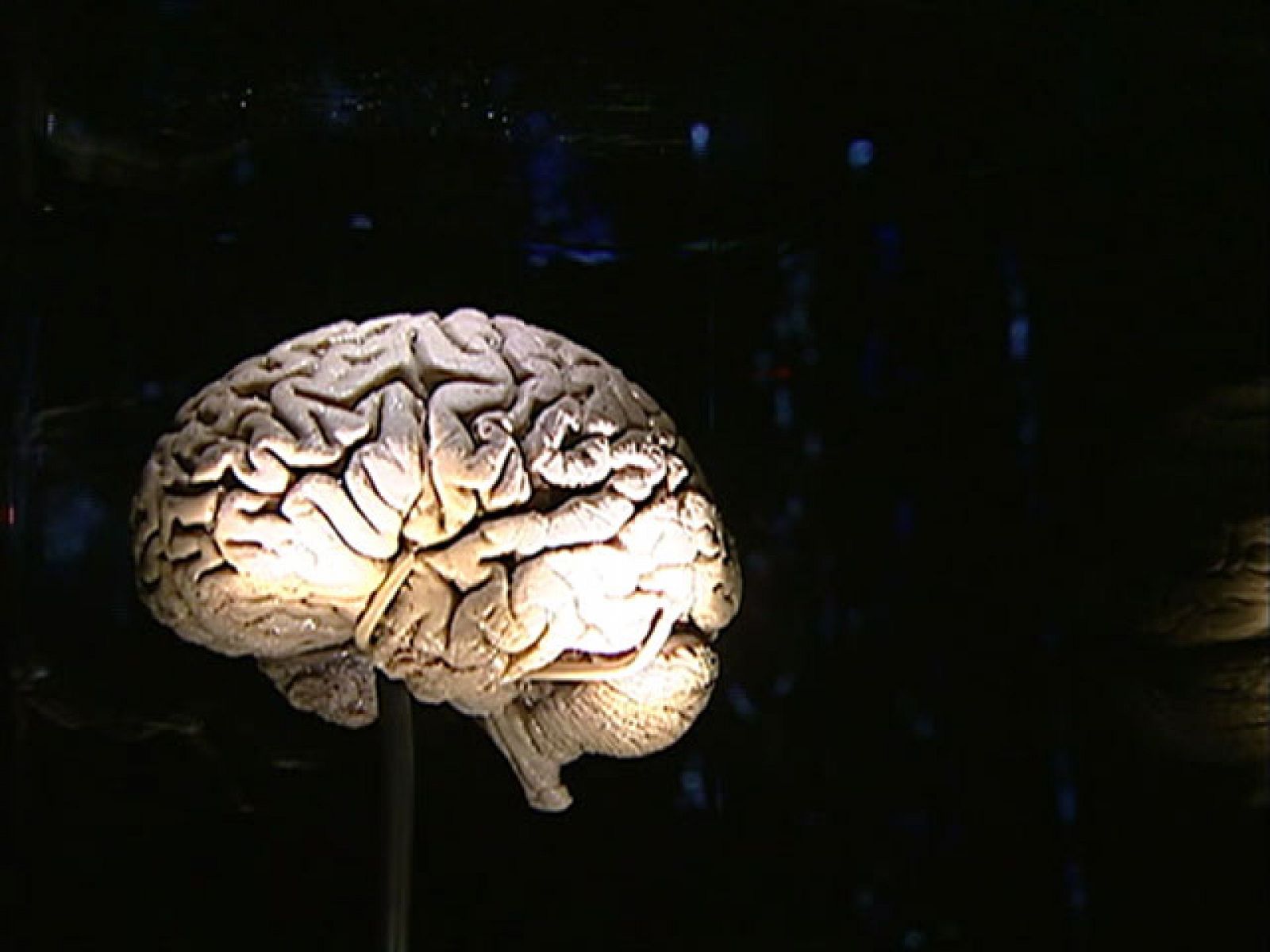 Los misterios del cerebro humano al descubierto