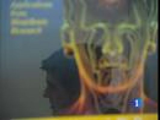 Telediario 1 - Incapacidad para sentir frustración